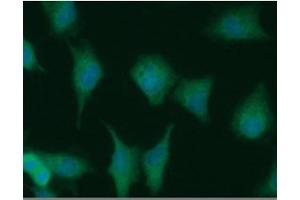 ICC/IF analysis of NUDT1 in A549 cells line, stained with DAPI (Blue) for nucleus staining and monoclonal anti-human NUDT1 antibody (1:100) with goat anti-mouse IgG-Alexa fluor 488 conjugate (Green). (NUDT1 anticorps)