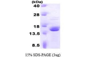 SDS-PAGE (SDS) image for FK506 Binding Protein 2, 13kDa (FKBP2) (AA 22-142) protein (ABIN667129) (FKBP2 Protein (AA 22-142))