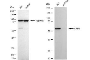 Western blotting analysis using CAP1 antibody (ABIN7797862).