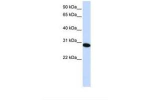 Image no. 1 for anti-PHD Finger Protein 19 (PHF19) (C-Term) antibody (ABIN6739282) (PHF19 anticorps  (C-Term))
