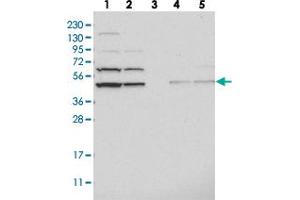 Western blot analysis of Lane 1: RT-4, Lane 2: U-251 MG, Lane 3: Human Plasma, Lane 4: Liver, Lane 5: Tonsil with ADSS polyclonal antibody  at 1:250-1:500 dilution. (ADSS anticorps)