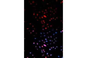 Immunofluorescence analysis of U2OS cells using Phospho-Jun-S73 antibody (ABIN5969904). (C-JUN anticorps  (pSer73, Ser73))