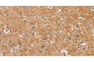 Immunohistochemistry of paraffin-embedded Human brain using CYP4A11 Polyclonal Antibody at dilution of 1:30 (CYP4A11 anticorps)