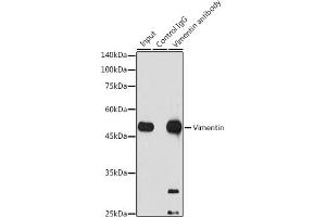 Immunoprecipitation analysis of 300 μg extracts of Jurkat cells using 3 μg Vimentin antibody (ABIN7271326).