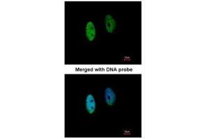 ICC/IF Image Immunofluorescence analysis of paraformaldehyde-fixed HeLa, using DENND1B, antibody at 1:200 dilution.