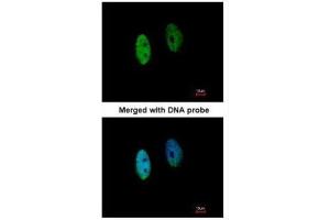 ICC/IF Image Immunofluorescence analysis of paraformaldehyde-fixed HeLa, using DENND1B, antibody at 1:200 dilution. (DENND1B anticorps  (Center))