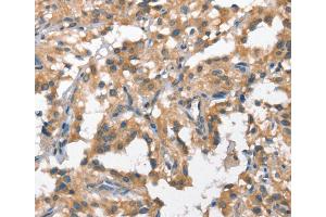 Immunohistochemistry (IHC) image for anti-Hepatocyte Growth Factor (Hepapoietin A, Scatter Factor) (HGF) antibody (ABIN2421656) (HGF anticorps)