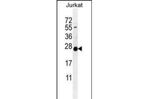 POLR2J Antibody (C-Term) (ABIN655247 and ABIN2844848) western blot analysis in Jurkat cell line lysates (35 μg/lane).