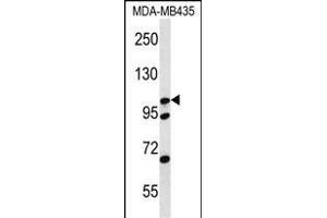 CTNND2 Antibody (C-term) (ABIN656479 and ABIN2845759) western blot analysis in MDA-M cell line lysates (35 μg/lane). (CTNND2 anticorps  (C-Term))