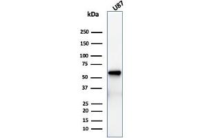 Western Blot Analysis of U87 cell lysate using NGFR Recombinant Mouse Monoclonal Antibody (rNGFR/1965). (Recombinant NGFR anticorps  (AA 281-421))