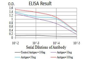 Black line: Control Antigen (100 ng),Purple line: Antigen (10 ng), Blue line: Antigen (50 ng), Red line:Antigen (100 ng)