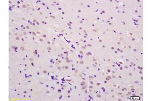 Formalin-fixed and paraffin embedded rat brain labeled with Rabbit Anti phospho-SHC(Tyr239/240) Polyclonal Antibody, Unconjugated (ABIN745973) at 1:200 followed by conjugation to the secondary antibody and DAB staining