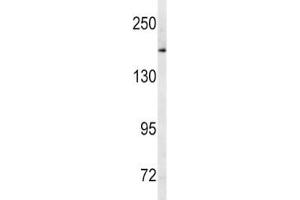 Western blot analysis of MRP1 antibody and human Ramos lysate. (ABCC1 anticorps  (AA 1247-1275))