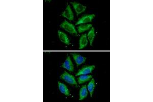ICC/IF analysis of Tomm20 in HeLa cells.