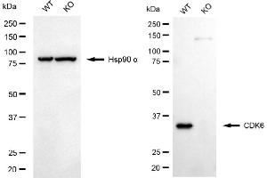 Western blotting analysis using CDK6 antibody (ABIN7798219).