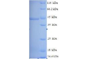 SDS-PAGE (SDS) image for Lysozyme (LYZ) (AA 212-462) protein (His-SUMO Tag) (ABIN5711861)