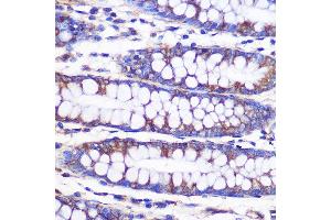 Immunohistochemistry of paraffin-embedded Human colon using NEK9 antibody (ABIN7268914) at dilution of 1:100 (40x lens).
