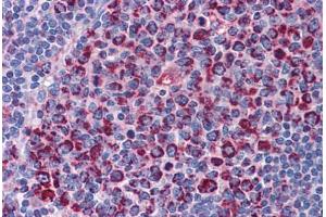 Human Tonsil: Formalin-Fixed, Paraffin-Embedded (FFPE)