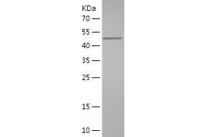 Western Blotting (WB) image for Zinc Finger E-Box Binding Homeobox 2 (ZEB2) (AA 1012-1214) protein (His-IF2DI Tag) (ABIN7125773)