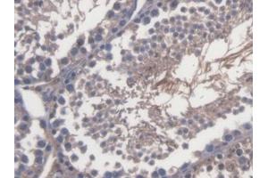 DAB staining on IHC-P; Samples: Mouse Testis Tissue