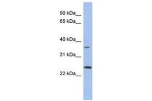 Image no. 1 for anti-WBP2 N-terminal Like (WBP2NL) (N-Term) antibody (ABIN6743704) (WBP2NL anticorps  (N-Term))