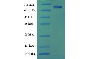 SDS-PAGE (SDS) image for CNDP Dipeptidase 2 (Metallopeptidase M20 Family) (CNDP2) (AA 2-475) protein (His tag) (ABIN5711715)