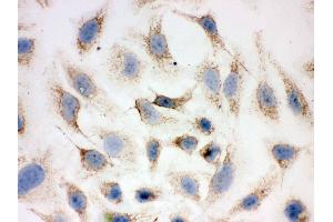 IHC analysis of Peroxiredoxin 3 using anti-Peroxiredoxin 3 antibody .