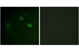 Immunofluorescence analysis of COS7 cells, using CDK1/CDC2 (Phospho-Thr14) Antibody. (CDK1 anticorps  (pThr14))