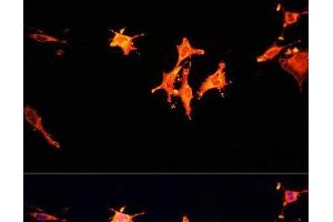 Immunofluorescence analysis of C6 cells using MST1 Polyclonal Antibody at dilution of 1:100. (MST1 anticorps)