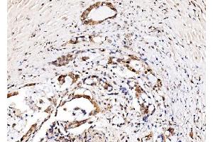 IHC analysis of IFI16 using anti-IFI16 antibody (ABIN7600374). (IFI16 anticorps  (AA 183-743))
