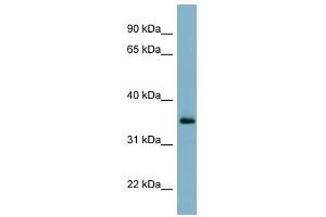GEM antibody used at 1 ug/ml to detect target protein. (GEM anticorps  (N-Term))
