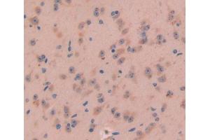 DAB staining on fromalin fixed paraffin- embedded brain tissue) (OXT anticorps  (AA 20-124))