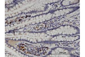 Image no. 1 for anti-Mannosyl (Alpha-1,6-)-Glycoprotein beta-1,6-N-Acetyl-Glucosaminyltransferase (MGAT5) (AA 642-740) antibody (ABIN599401) (MGAT5 anticorps  (AA 642-740))