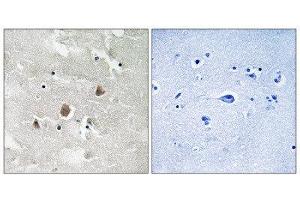 Immunohistochemistry (IHC) image for anti-Mitogen-Activated Protein Kinase Kinase Kinase 1 (MAP3K1) (pThr1402) antibody (ABIN1847608) (MAP3K1 anticorps  (pThr1402))
