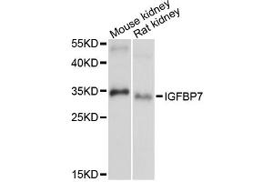 Western blot analysis of extracts of various cell lines, using IGFBP7 antibody (ABIN6293120) at 1:1000 dilution. (IGFBP7 anticorps)