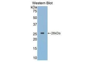 Western blot analysis of recombinant Simian CTSK.