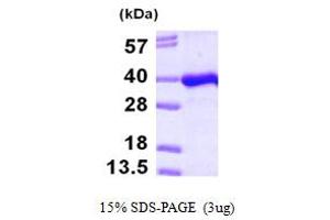 SDS-PAGE (SDS) image for Phosphotidylinositol Transfer Protein, beta (PITPNB) (AA 1-271) protein (His tag) (ABIN667260)