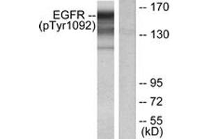 Western Blotting (WB) image for anti-Epidermal Growth Factor Receptor (EGFR) (pTyr1092) antibody (ABIN2888397) (EGFR anticorps  (pTyr1092))