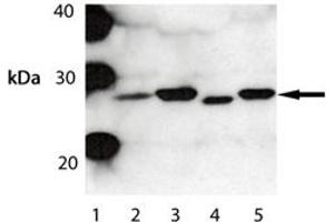 Western blot analysis of Bak . (BAK1 anticorps)