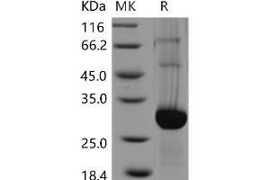 Western Blotting (WB) image for GLI Pathogenesis-Related 1 (GLIPR1) protein (His tag) (ABIN7320125)