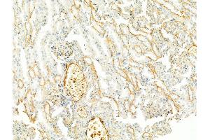 ABIN6256011 and ABIN6267476 at 1/100 staining Mouse kidney tissue by IHC-P. (Cadherin 5 anticorps  (pTyr731))