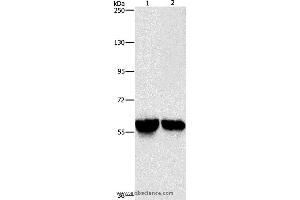 Western blot analysis of Mouse liver and kidney tissue, using ALDH8A1 Polyclonal Antibody at dilution of 1:800 (ALDH8A1 anticorps)