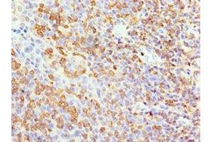 Immunohistochemistry of paraffin-embedded human tonsil tissue using ABIN7144041 at dilution of 1:100 (Amyloid beta (A4) Precursor Protein-Binding, Family B, Member 1 Interacting Protein (APBB1IP) (AA 1-150) anticorps)