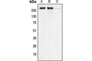Western blot analysis of Cav3. (CACNA1G anticorps  (Center))
