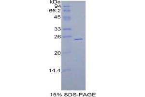 SDS-PAGE analysis of Rat GPX5 Protein. (GPX5 Protéine)