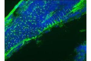 Immunofluorescence staining of a 9 days old zebrafish embryo (Desmin K5 anticorps)