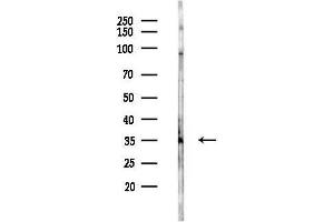 anti-HtrA Serine Peptidase 1 (HTRA1) (Internal Region) antibody