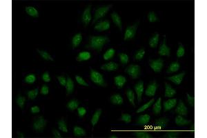 Immunofluorescence of monoclonal antibody to NR1H4 on HeLa cell. (NR1H4 anticorps  (AA 363-472))