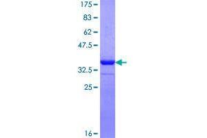 Image no. 1 for Fibronectin Type III Domain Containing 5 (FNDC5) (AA 14-78) protein (GST tag) (ABIN1354285)