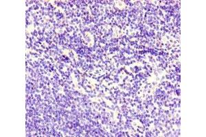 Immunohistochemistry of paraffin-embedded human lymph node tissue using ABIN7148573 at dilution of 1:100